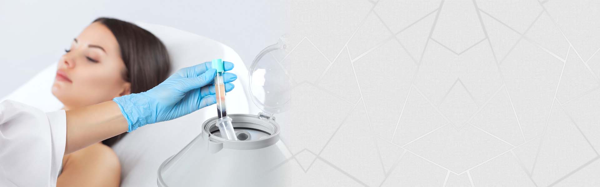 regain hair by prp hair treatment at zafeerah skin clinic mumbai